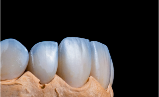 Corone in Zirconio