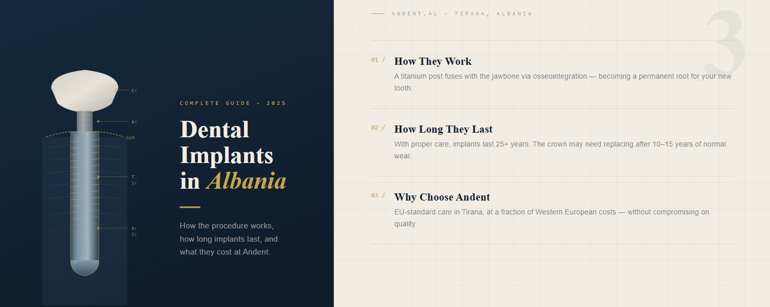 dental implants Albania how they work