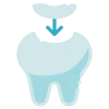 Dental-Fillings Otturazioni dentali