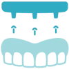 Placement-of-crowns-or-bridges Placement of crowns or bridges