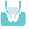 Tooth-Extractions Estrazioni di denti